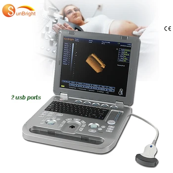 Портативный ультразвуковой аппарат Sun-800D для 3D-УЗИ беременных